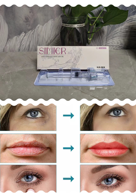 คุณภาพดี Feamle Beauty Products Medical Anti-Aging Derm Dermal Filler 2 Ml