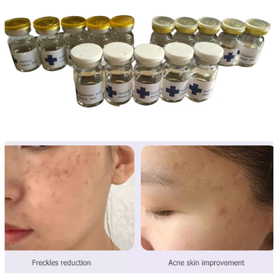 Hyamely Non Cross Linked Hyaluronic Acid Mesotherapy Solution 5 มิลลิตร
