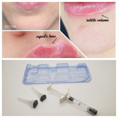 1 มล Juvederm Medical Natrium Hyaluronate Gel Hyaluronic Acid เจลฉีดสําหรับสะพานจมูก