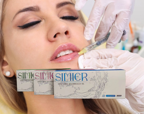 2ml Cross Linked Hyaluronic Acid Ha Dermal Filler สำหรับจมูกคางริมฝีปาก