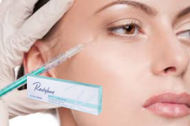 ริมฝีปาก ริมแก้ม ไฮยอลูรอนิกแอซิด ผิวหนัง Filler Refyne Defyne Silk Lyft