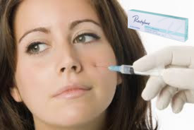 20 มกราม/มล การฉีดลิป Lift Dermal Filler แบบเรียบยาวนาน