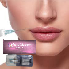 ไฮยอลูรอนิกแอซิด ผิวหนัง เติมฝีปากฉีด Juvederm Ultra3 Ultra4 Voluma