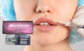 2 * 1 มล Juvederm Ultra 3 Lip Filler Hyaluronic Acid Gel Fillers ผสมผสมผสมผสมผสมผสมผสมผสมผสมผสมผสมผสม