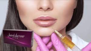Juvederm Ultra 3 ไฮยอลูรอนิกแอซิด HA Dermal Filler 2ml การเสริมริมฝีปาก