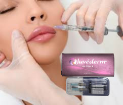 2 X 1 ml Juvederm Ultra 4 สารเติมผิวหนังสําหรับฉีด