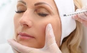 รอยเรียบ สารเติมผิวหนังสําหรับฉีด กรดไฮลูรอนิก Juvederm Ultra 3 2*1ml