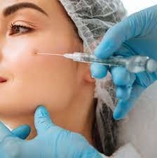 รอยเรียบ สารเติมผิวหนังสําหรับฉีด กรดไฮลูรอนิก Juvederm Ultra 3 2*1ml